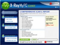   X-Ray MyPC